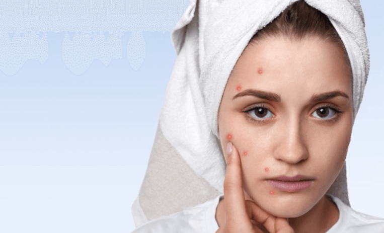 Skin Specialist in Lucknow